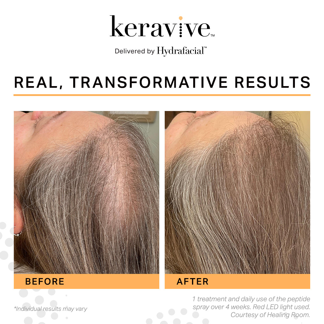 Keravive
